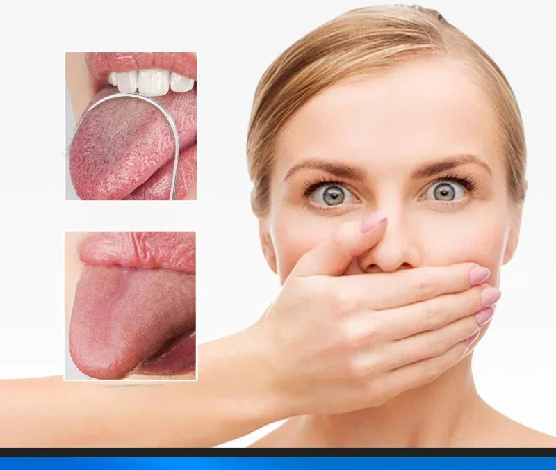 Stainless U-Lingua – Raspador de aço inoxidável em forma de U para limpeza profunda