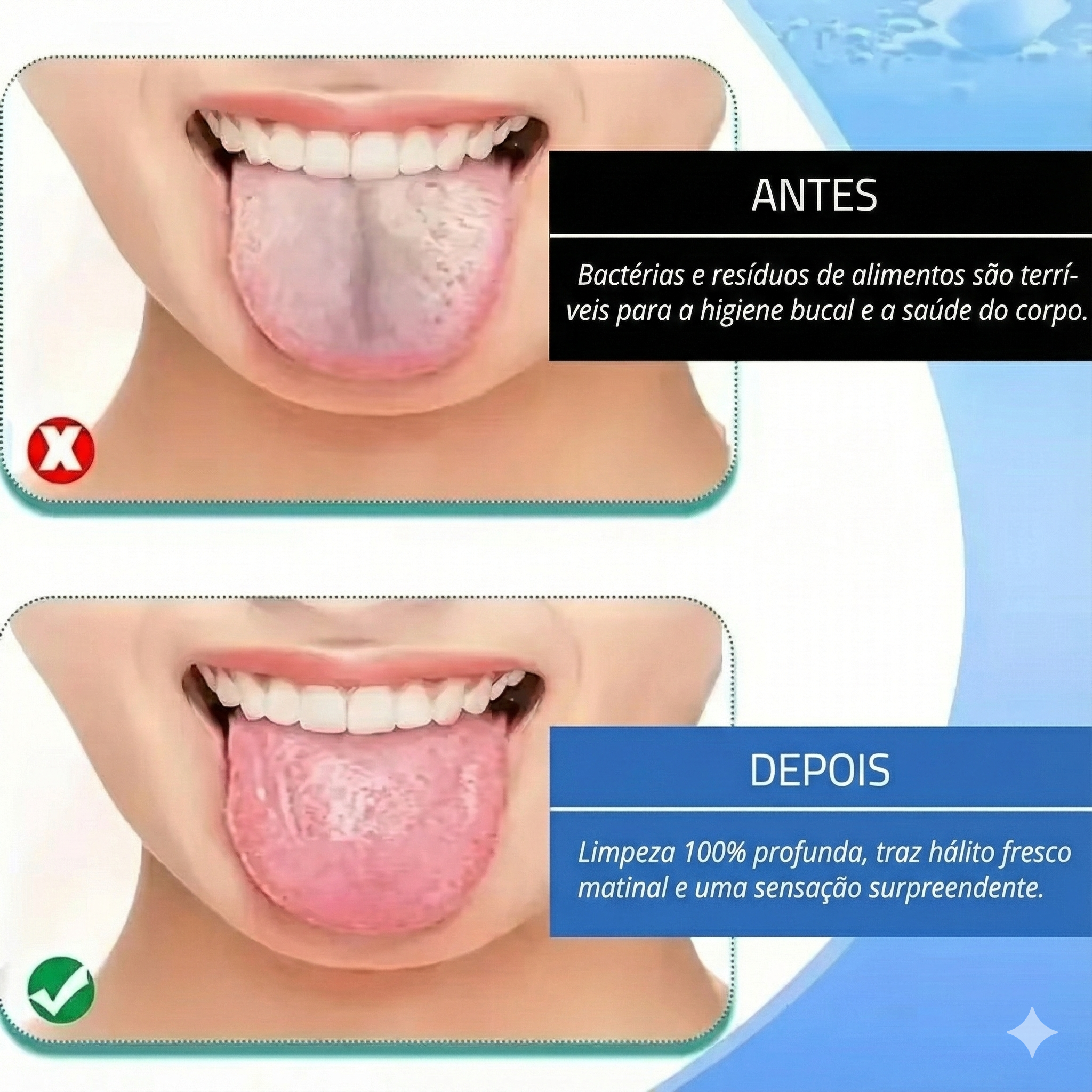 Stainless U-Lingua – Raspador de aço inoxidável em forma de U para limpeza profunda